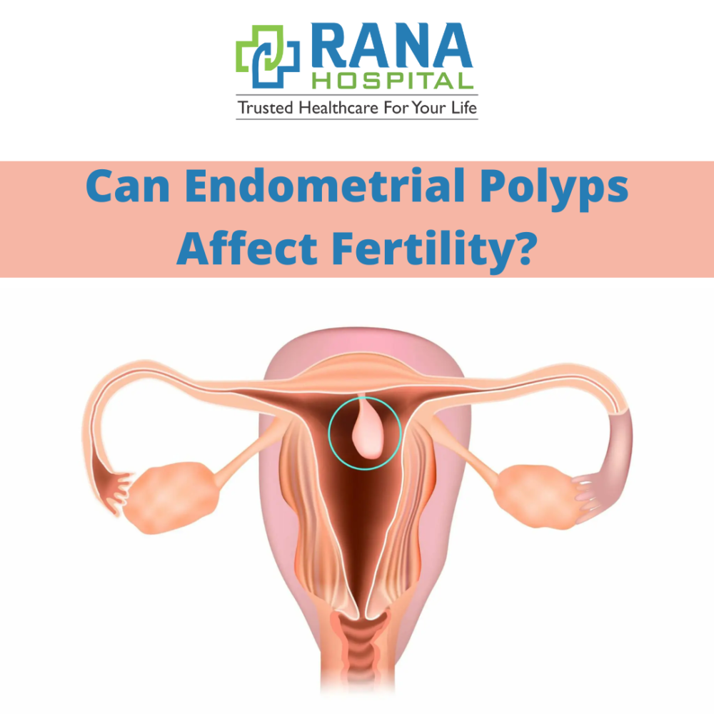 Can Endometrial polyps affect fertility?