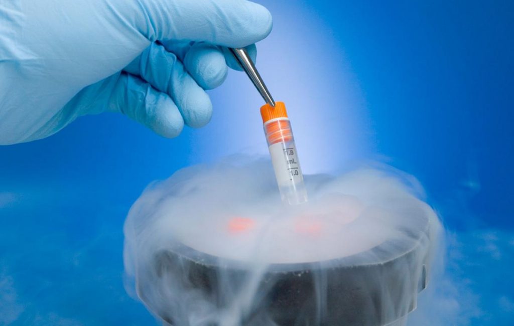 Semen Bank/ Cryopreservation