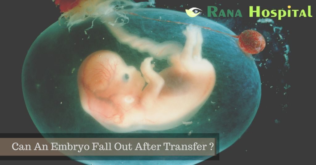 Can An Embryo Fall Out After Transfer
