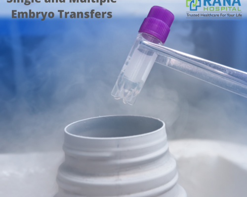 Single and Multiple Embryo Transfers