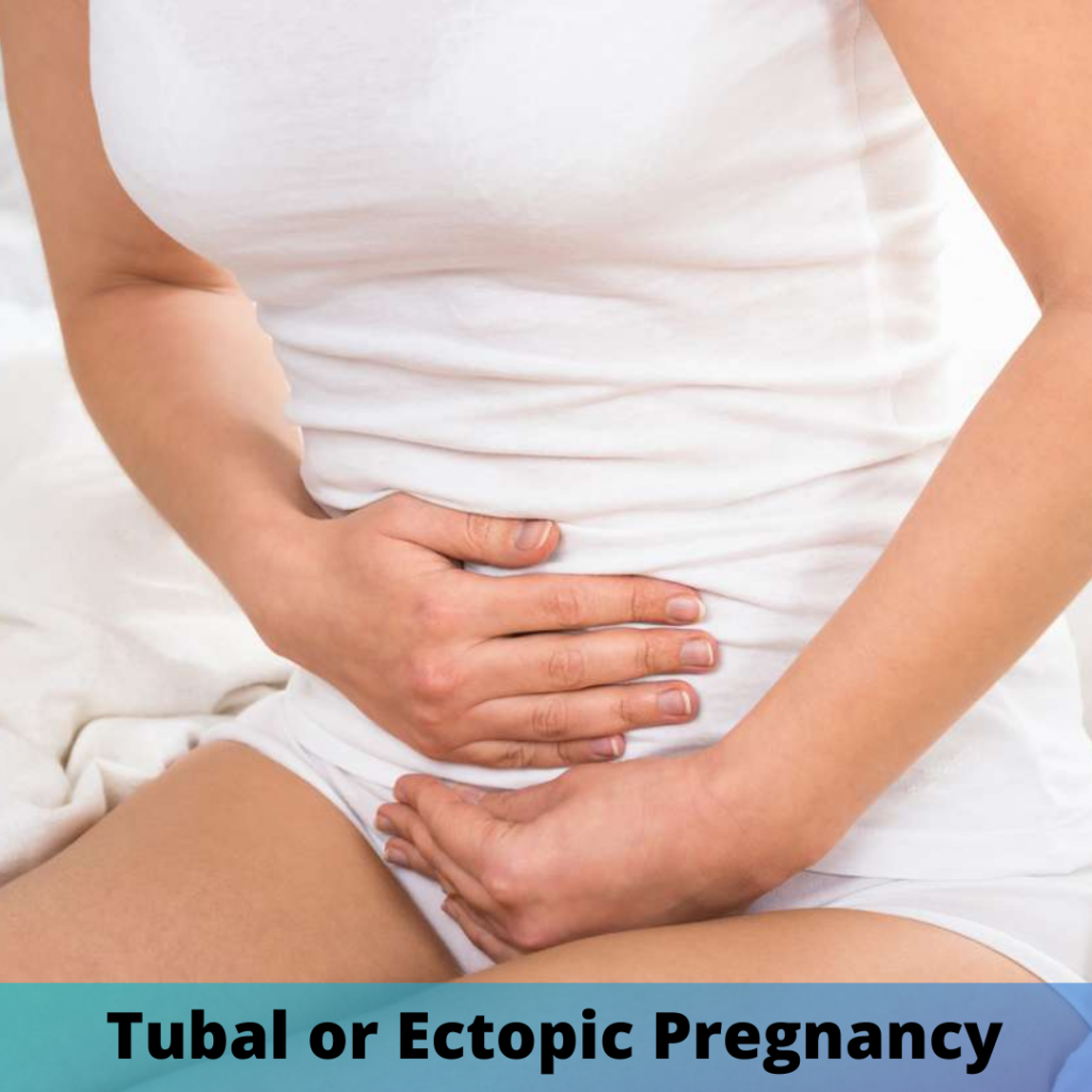 Tubal or Ectopic Pregnancy